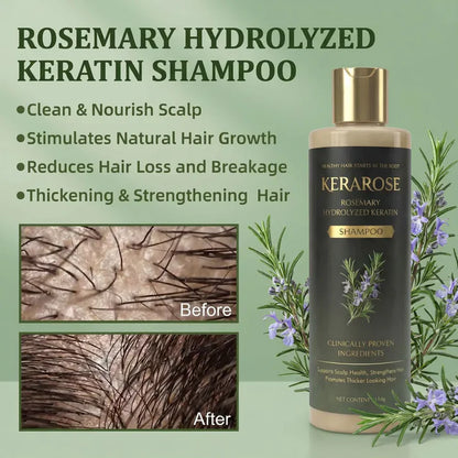 Kerarose Rosemary Shampoo For Hair Growth