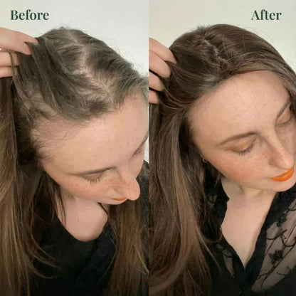 Kerarose Rosemary Shampoo For Hair Growth