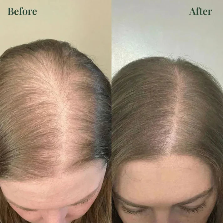 Kerarose Rosemary Shampoo For Hair Growth